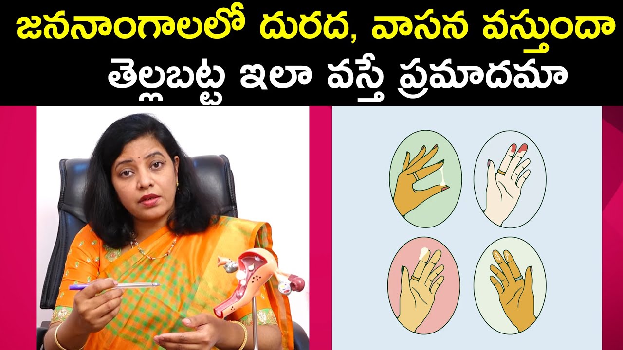 Is White Discharge Is Dangerous | Symptoms Of White Discharge | Dr. Nayani | Ferty9 Hospital