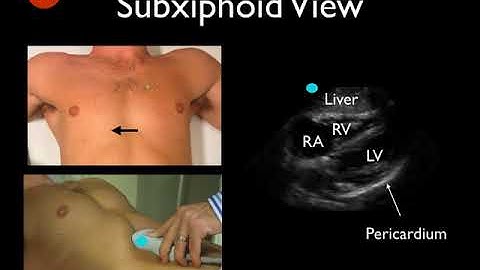 Video 1   Tutorial on basic echocardiography views