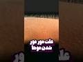 علت مورمور شدن موها 