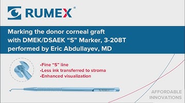 Surgery Live! Eric Abdullayev, MD, performs marking the corneal graft with DMEK/DSAEK "S" Marker