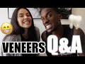 VENEERS Q&A!! EVERYTHING YOU NEED TO KNOW ABOUT DENTAL CENTRE TURKEY!!!