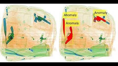 Anomaly detection in X-ray scanned baggage
