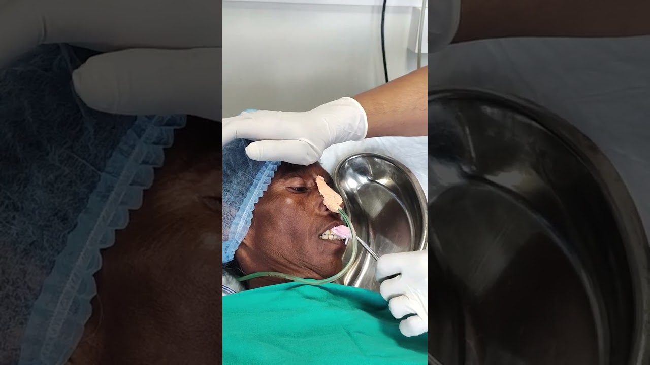 Patient Oral care /Mouth care for Unconscious Patient / Oral care demonstration/ Practical nursing 