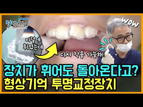 🔥전박사 열정을 끌어올린 장치🔥 형상 기억 투 명교정 장치 등장😎✅