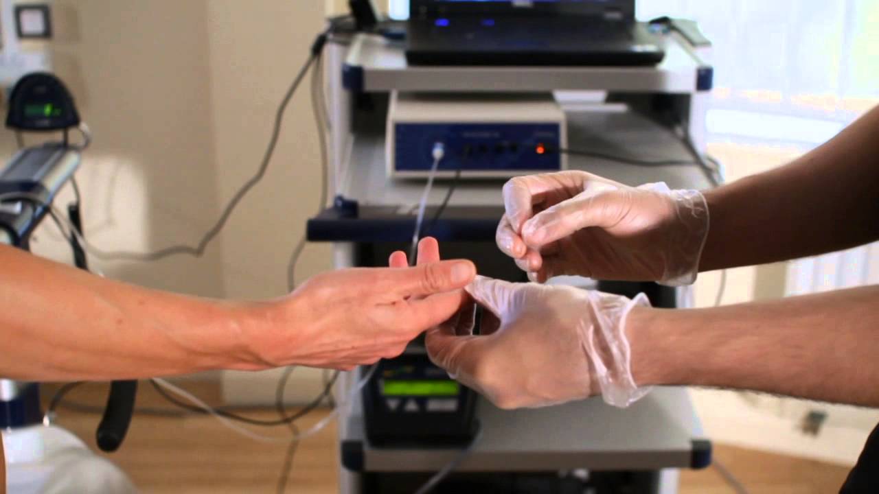 test report blood YouTube Accumulation Blood Lactate