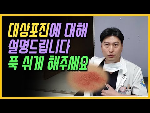 대상포진걸리면 어떻게?