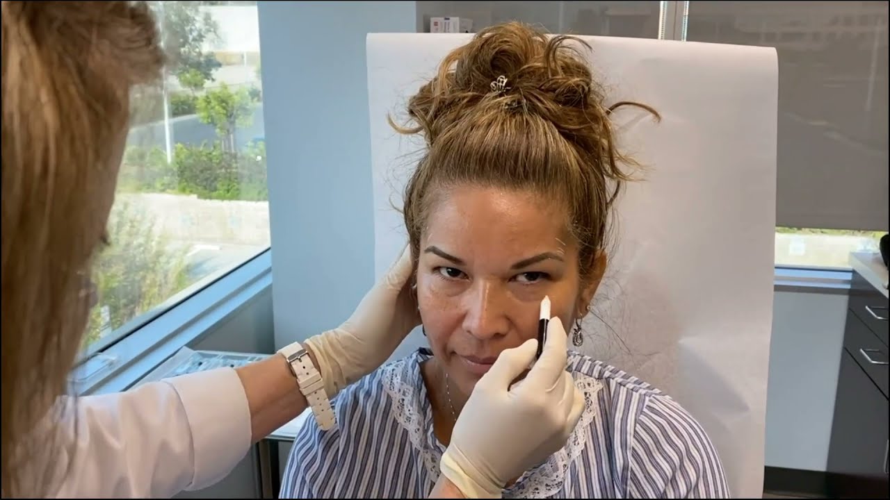 Dermatologists Perform Treatment Demonstration of RHA Line of Fillers Followed by an Informative Q+A