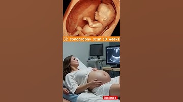 3D sonography scan 10 weeks #weekspregnant #viralvideo #shorts#momtobe #pregnancybyfaith