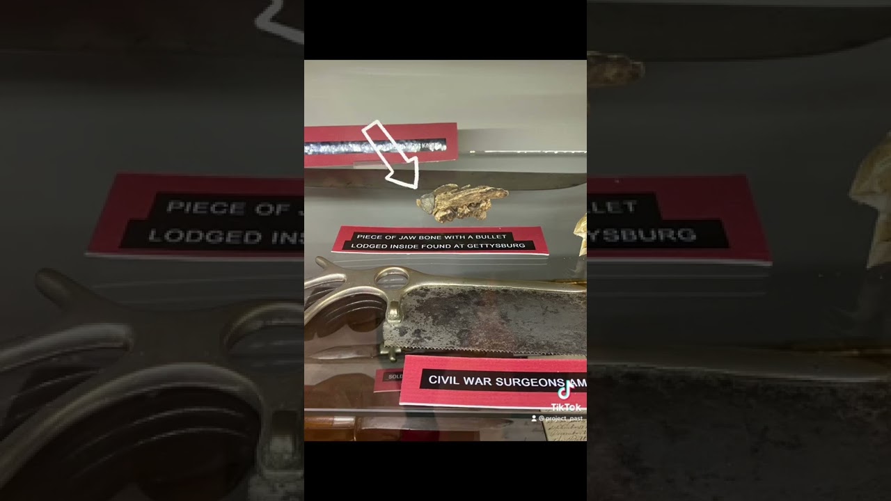 SHOCKING Civil War Artifact  