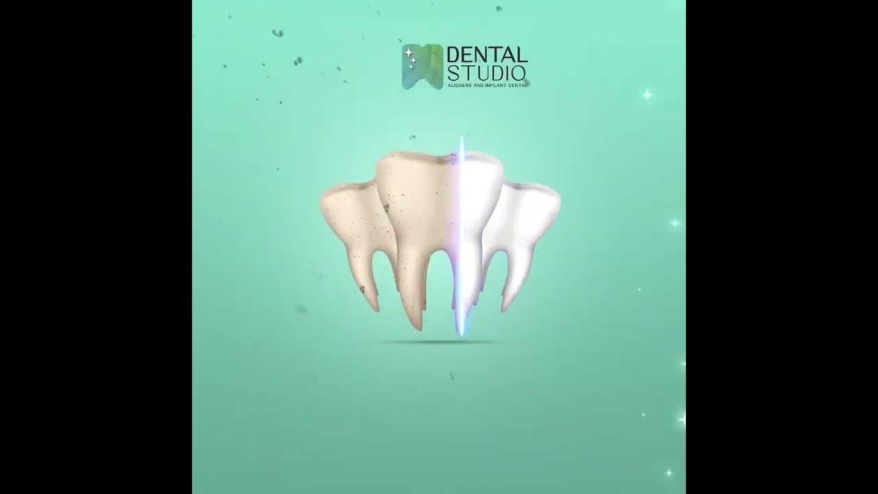 DENTAL TEETH WHITENING (DENTAL STUDIO) 