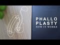 How Phalloplasty Works | FTM Transgender