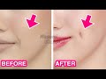 5mins dimples exercise simple facial exercises to get dimples without surgery