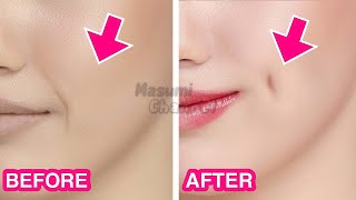 5mins Dimples Exercise! Simple Facial Exercises to get Dimples without Surgery