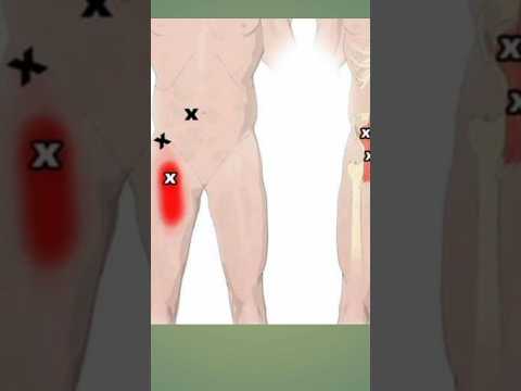 psoas muscle pain, stretching, release, strengthening, abscess ultrasound, anatomy, massage,