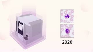 Improving Laboratory Efficiency with Digital Cell Morphology Analyzers by MindrayInternational 709 views 2 months ago 3 minutes, 9 seconds