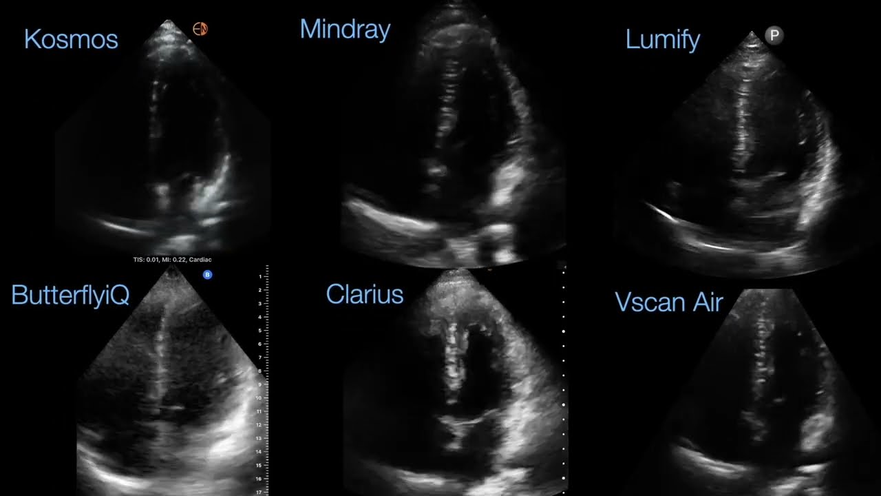 6 Handheld ultrasound direct comparison, head to head  2024