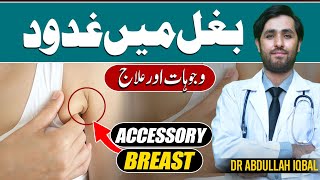 Painful Armpit Fat or Armpit Lump | Bagal ki Charbi Ka Ilaj | Treatment of Underarm Fat