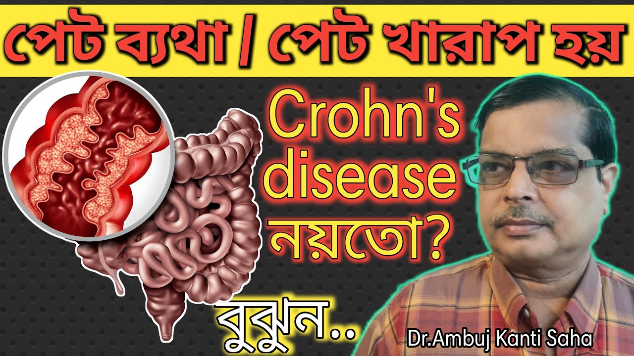 Discussion on Crohn's disease home remedies and homeopathic treatment