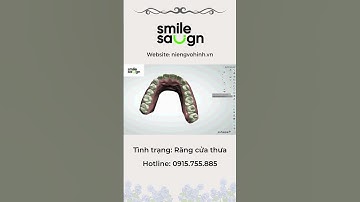 Phác đồ niềng răng - Smilesalign Việt Nam