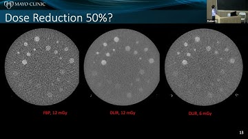 Image quality evaluation of deep learning image reconstruction and denoising in clinical CT