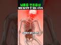 뇌졸중이 덮치기 직전의 4가지 징조😮