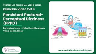 2/6 video- Mal de Débarquement: Pathophysiology — Velocity Storage Maladaptation