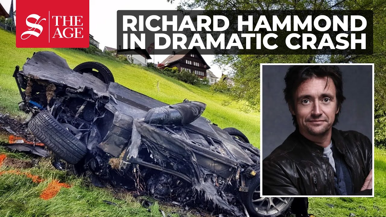 Richard Hammond Injuries