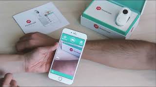 Dermatoscope MoleScope II - The App 101 screenshot 3