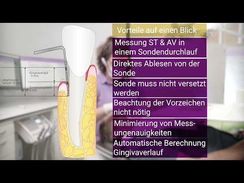 Video: Expression Und Klinische Bedeutung Von PD-L1, B7-H3, B7-H4 Und TILs Bei Menschlichem Kleinzelligem Lungenkrebs (SCLC)