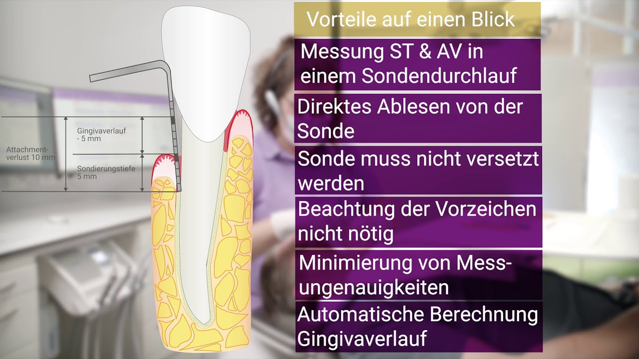 Messung Attachmentverlust YouTube