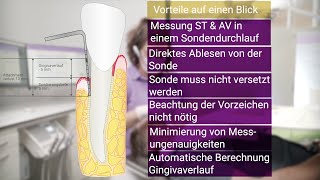 Messung Attachmentverlust