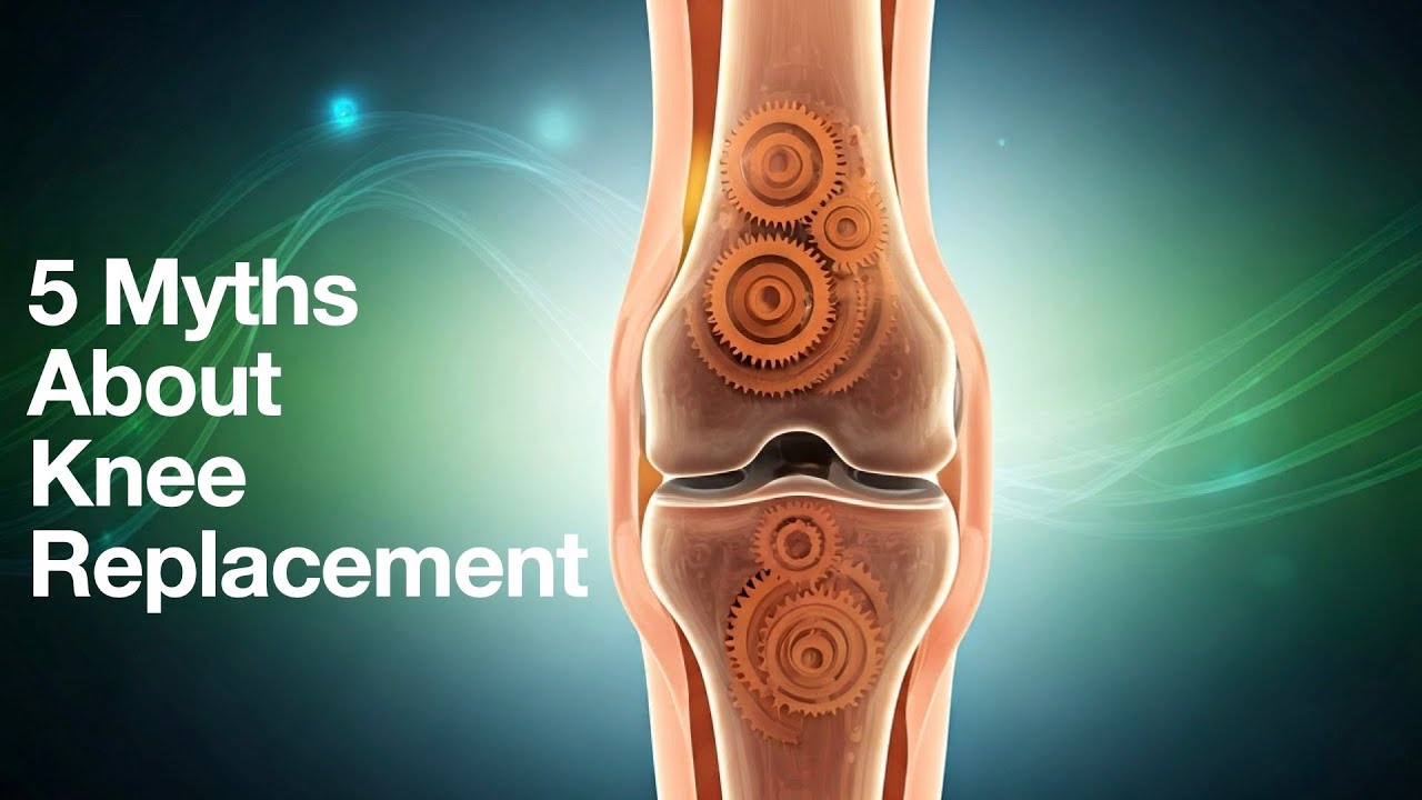 Debunking Popular Knee Replacement Misconceptions