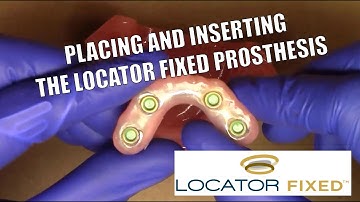 Placing & Inserting the LOCATOR FIXED Prosthesis - How to and Clinical Steps