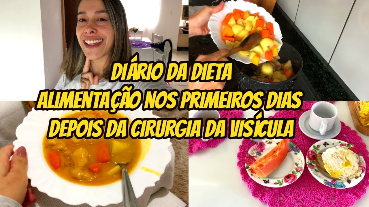 Diário da dieta- Minha alimentação nos primeiros dias pós cirurgia de ...