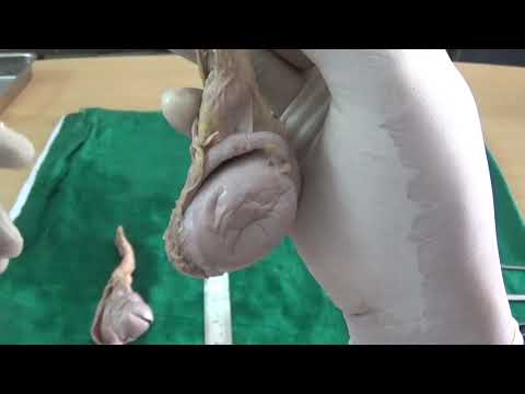 Anatomy Tutorial testis