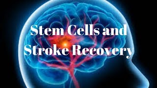 Stem cell research and stroke recovery