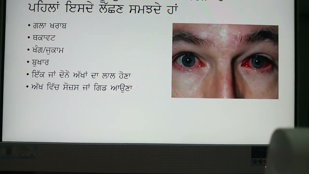 eye flu precautions punjabi