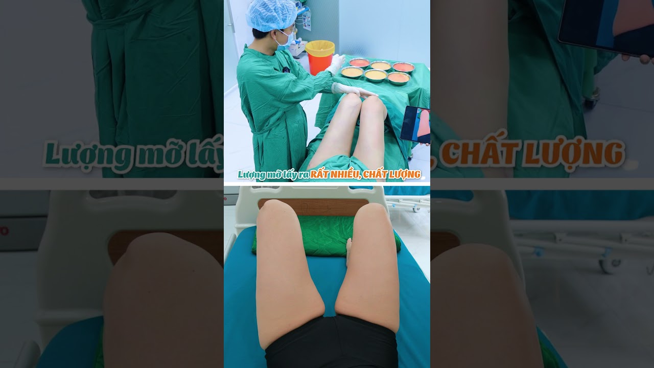 boom brothers slot Đùi thon gọn, săn chắc chỉ sau 90 phút thực hiện hút mỡ - Bác sĩ Lương Ngọc