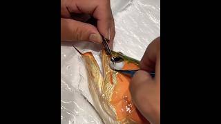 Crazy Arowana Eye Surgery An Eye Opener
