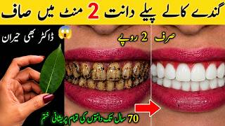 just in 2 minutes will make dirty, rotten, yellow teeth shine as pearls 😱 / Teeth whitening remedy