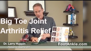 Arthritis of the Big Toe Joint (Hallux Rigidus) - Treatment Ideas from Podiatrist Larry Huppin