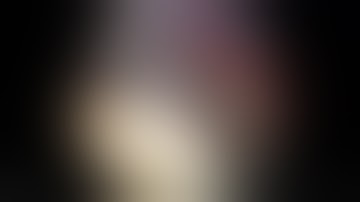 ConMed Linvatec Single Row Rotator Cuff Repair using Allopatch HD™   Surgical Technique Video