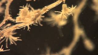 Hydrozoa