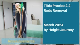 My Upcoming Tibia Rod Removal Surgery - March 2024