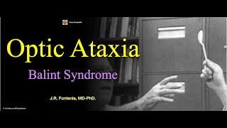 Optic Ataxia.