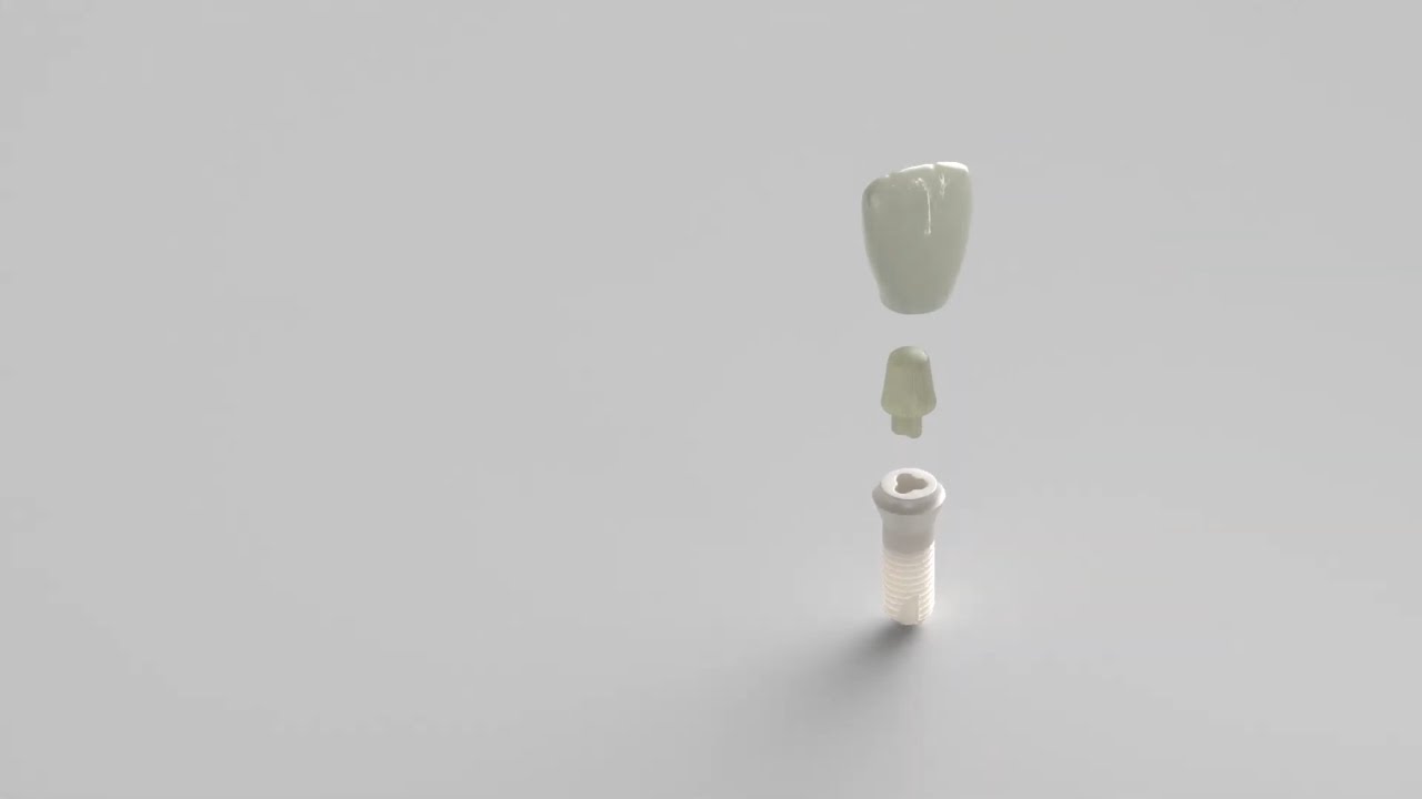 Prevent Periimplantitis with Patent™ Implants