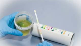 Urinteststreifen richtig benutzen - Blasenentzündung, Krebs & Zucker feststellen? | Urologie am Ring