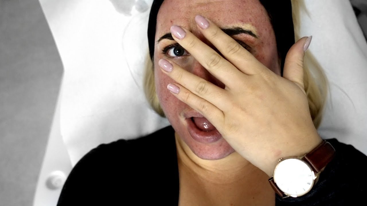 ZROBIŁAM SOBIE TWARZ 😱