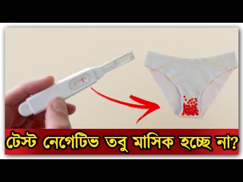 ভিডিও: সোশ্যাল মিডিয়া ছাড়া কীভাবে বাঁচবেন (ছবি সহ)