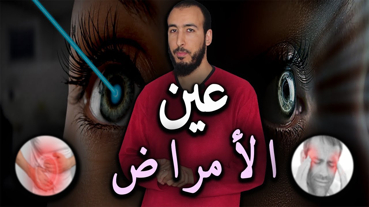 رقية العين المتسببة في الأمراض والأوجاع والآلام والأسقام